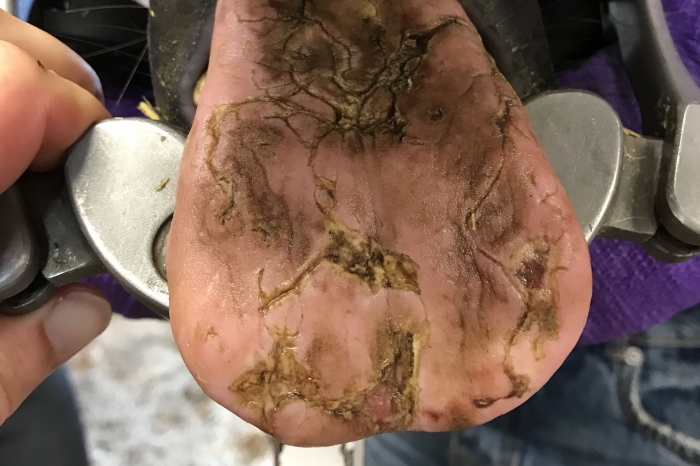 Ger sig på hästens tunga – så får du bukt med äggen