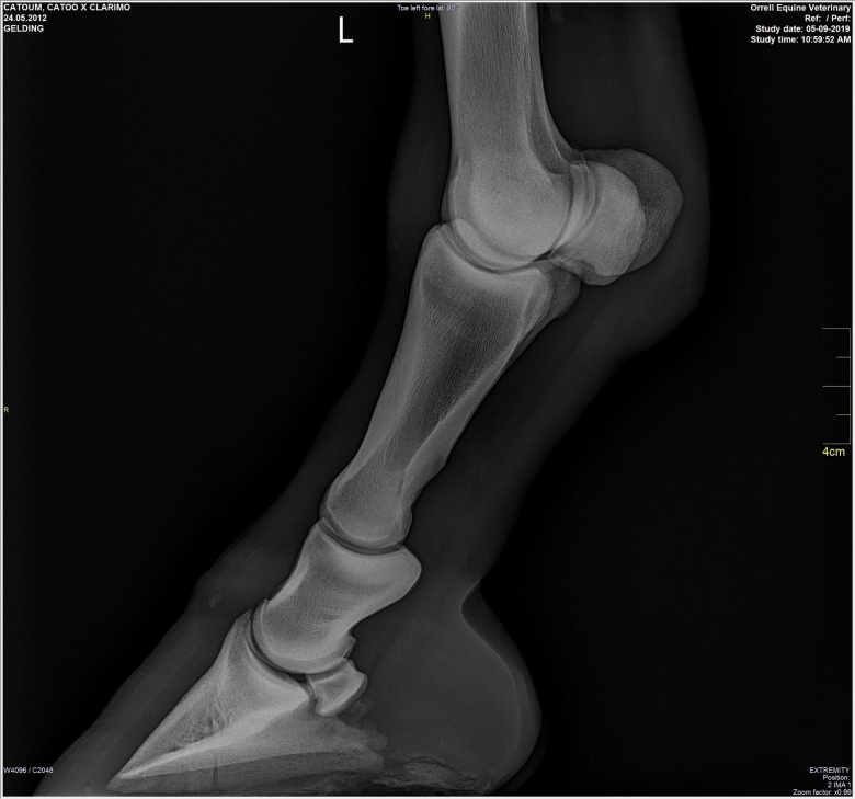 X-ray-00-(1)