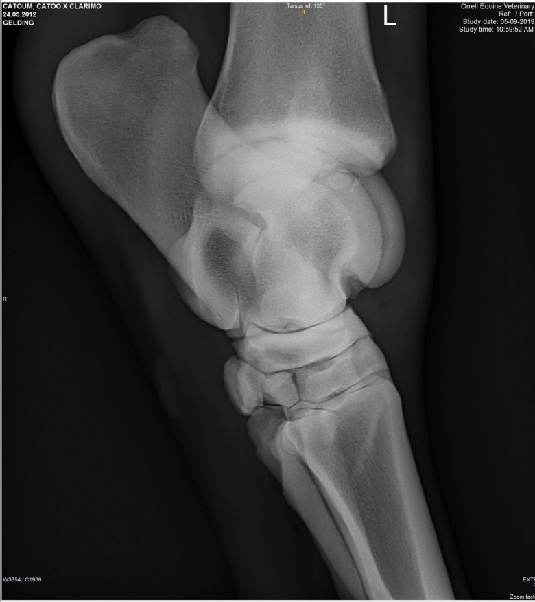 X-ray-00-(4)