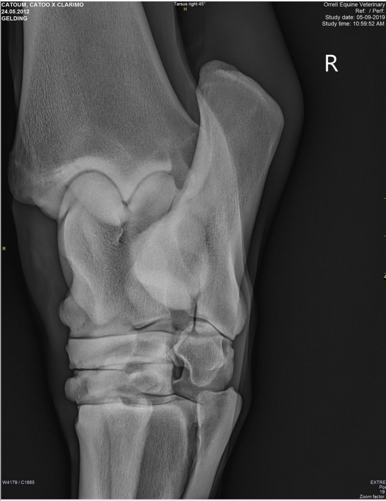 X-ray-00-(6)