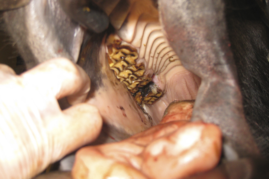 Tandfrakturer är vanligare än de flesta vet