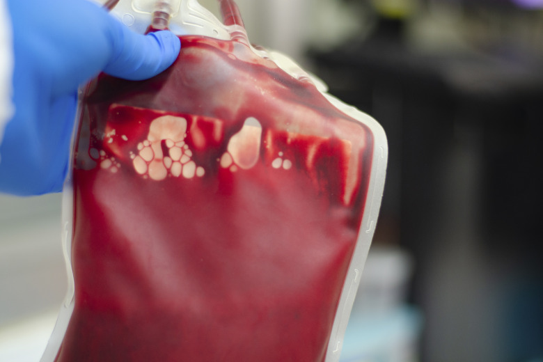 Akut blodgivning på häst: Så räddar veterinärteamet liv utan blodlager