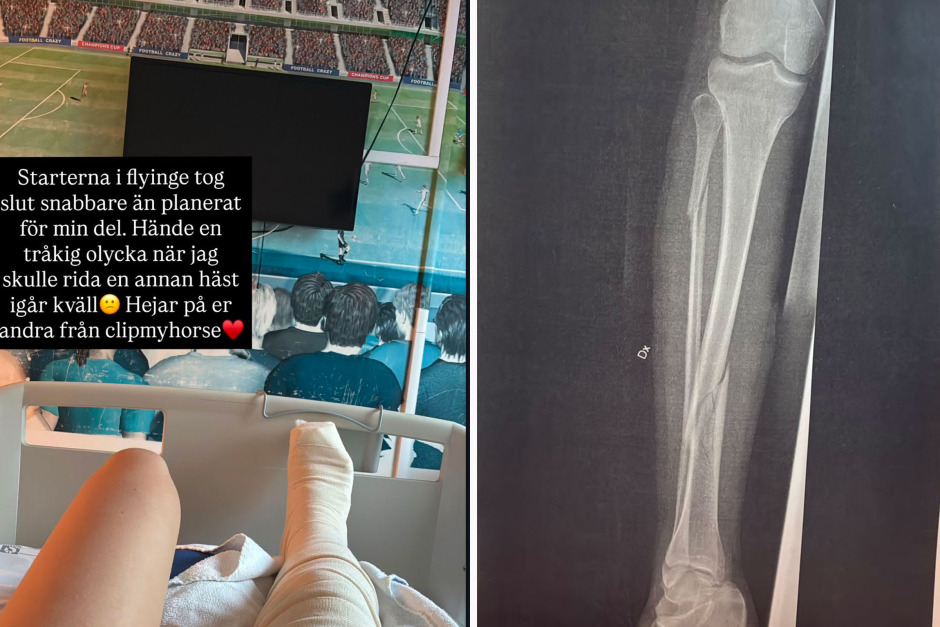 Svåra olyckan stoppar Ronja Kardos på Breeders: ”Båda benen i ena benet är av”